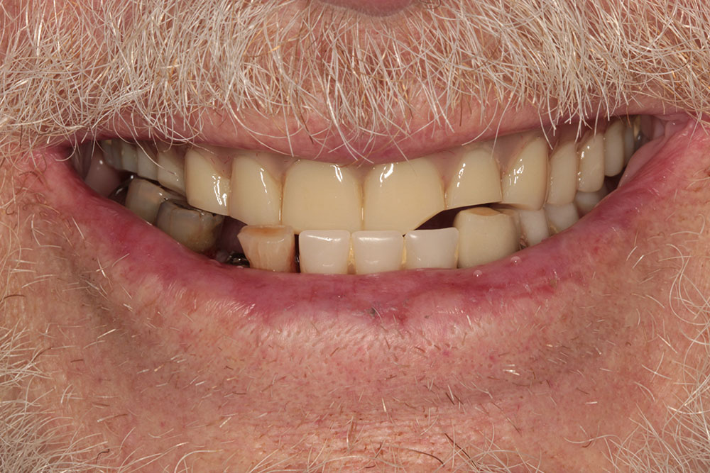 JR before